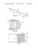 Vascular Occlusion Devices diagram and image