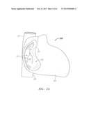 Clip-Based Systems and Methods for Treating Septal Defects diagram and image