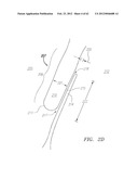 Clip-Based Systems and Methods for Treating Septal Defects diagram and image