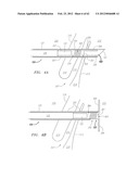 Clip-Based Systems and Methods for Treating Septal Defects diagram and image