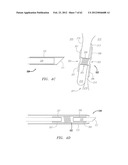 Clip-Based Systems and Methods for Treating Septal Defects diagram and image