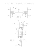 Clip-Based Systems and Methods for Treating Septal Defects diagram and image