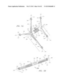 Clip-Based Systems and Methods for Treating Septal Defects diagram and image