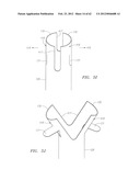 Clip-Based Systems and Methods for Treating Septal Defects diagram and image