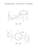 Clip-Based Systems and Methods for Treating Septal Defects diagram and image