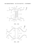 Clip-Based Systems and Methods for Treating Septal Defects diagram and image