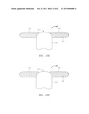 Clip-Based Systems and Methods for Treating Septal Defects diagram and image