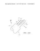 Clip-Based Systems and Methods for Treating Septal Defects diagram and image