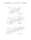 Clip-Based Systems and Methods for Treating Septal Defects diagram and image