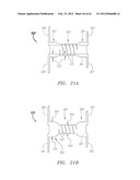 Clip-Based Systems and Methods for Treating Septal Defects diagram and image