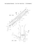 Clip-Based Systems and Methods for Treating Septal Defects diagram and image