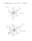 Clip-Based Systems and Methods for Treating Septal Defects diagram and image