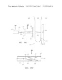 Clip-Based Systems and Methods for Treating Septal Defects diagram and image