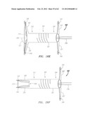 Clip-Based Systems and Methods for Treating Septal Defects diagram and image