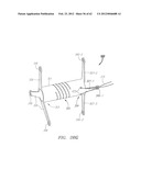 Clip-Based Systems and Methods for Treating Septal Defects diagram and image