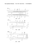 Clip-Based Systems and Methods for Treating Septal Defects diagram and image