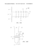 Clip-Based Systems and Methods for Treating Septal Defects diagram and image