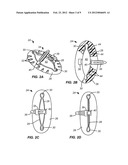 BIOPSY INCISION CLOSURE DEVICE diagram and image