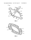 BIOPSY INCISION CLOSURE DEVICE diagram and image