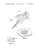 BIOPSY INCISION CLOSURE DEVICE diagram and image