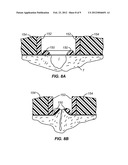 BIOPSY INCISION CLOSURE DEVICE diagram and image