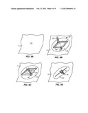 BIOPSY INCISION CLOSURE DEVICE diagram and image