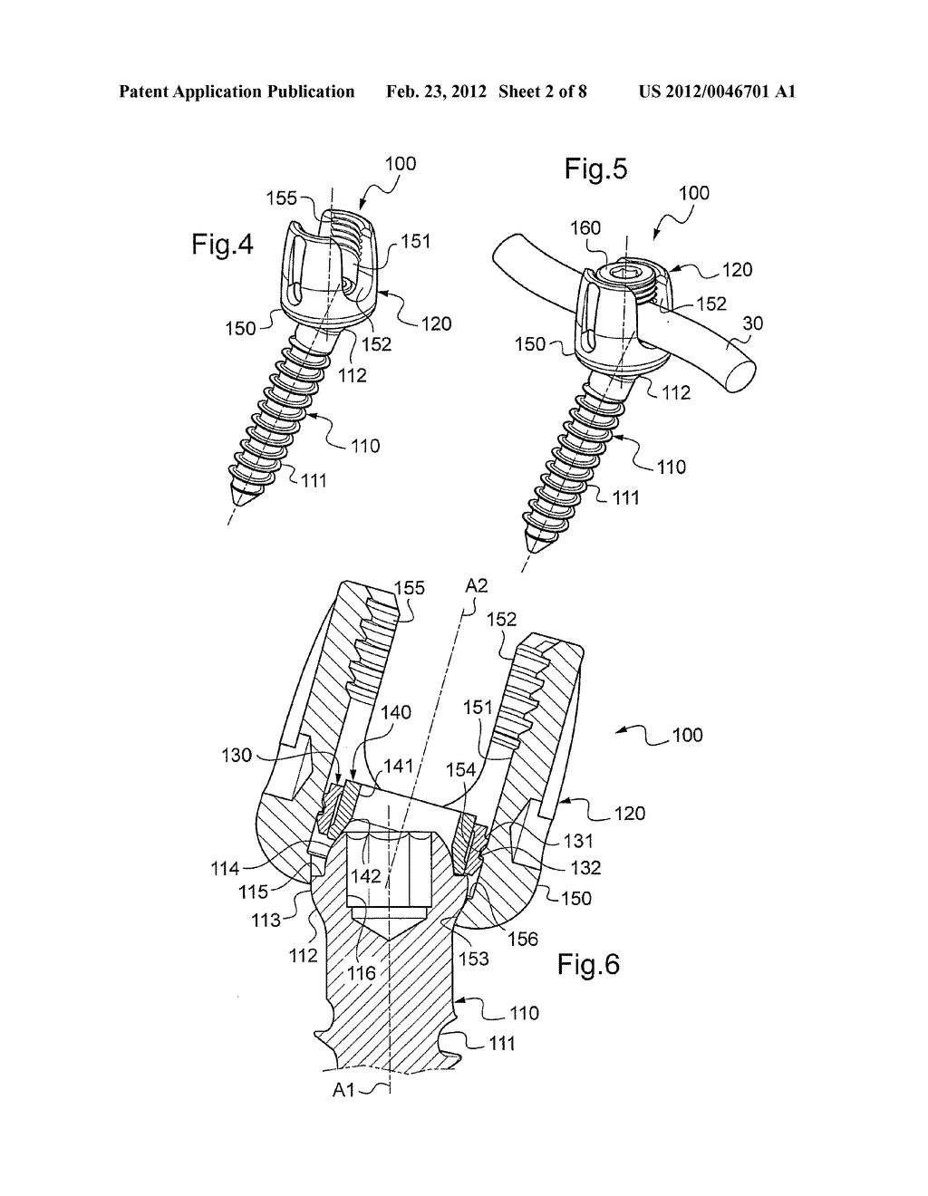 SPINAL IMPLANT WITH A LOCKABLE BALL JOINT - diagram, schematic, and image 03