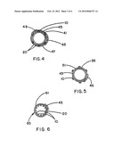 INTRALUMINAL STENT GRAFT diagram and image