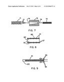 INTRALUMINAL STENT GRAFT diagram and image