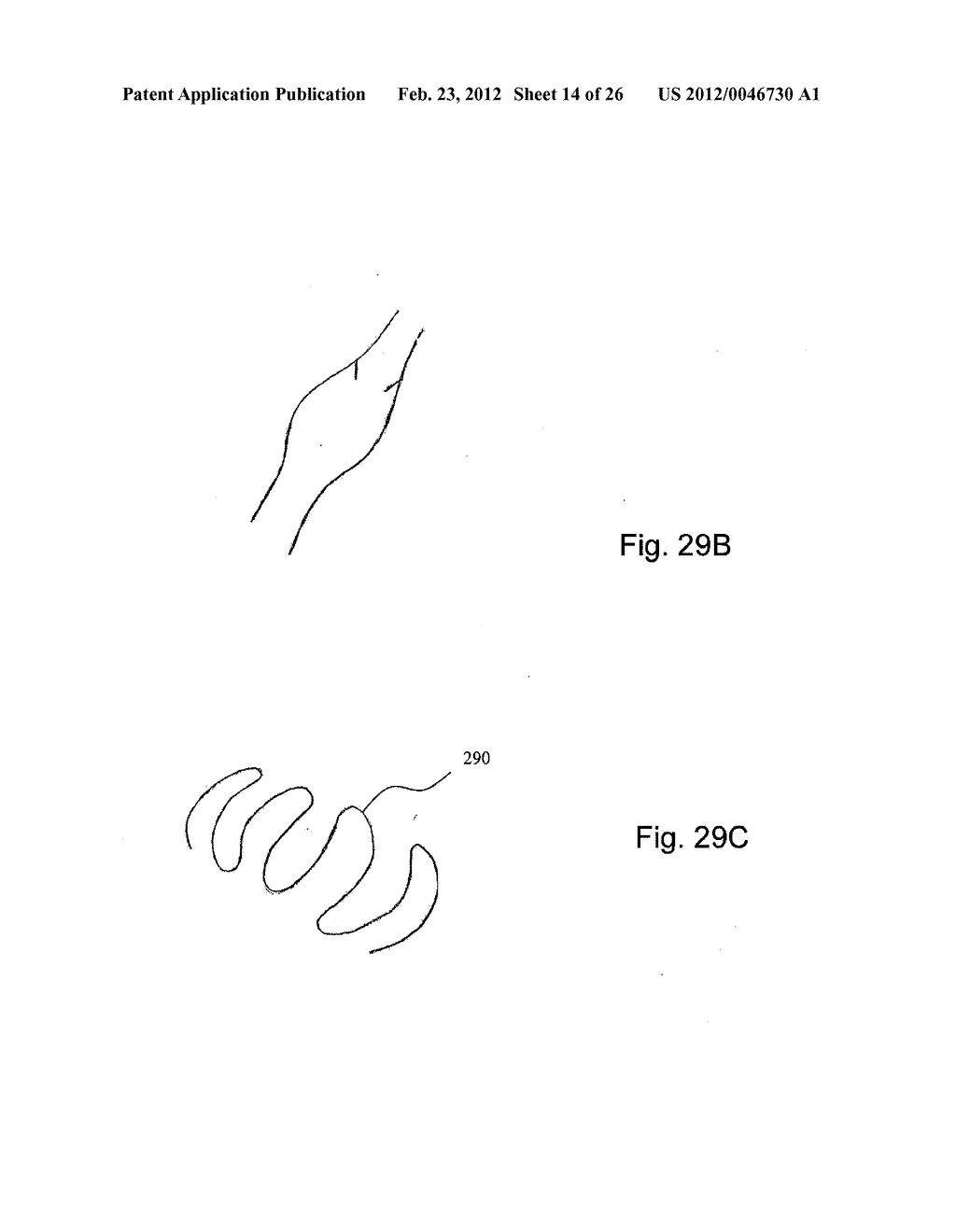 METHODS OF TREATING A CONDITION OF A VESSEL IN A PATIENT - diagram, schematic, and image 15