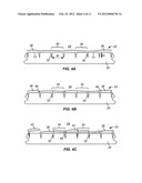 SURFACE TEXTURED IMPLANTS diagram and image