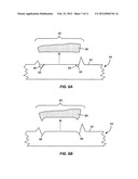 SURFACE TEXTURED IMPLANTS diagram and image