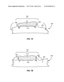 SURFACE TEXTURED IMPLANTS diagram and image