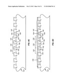 SURFACE TEXTURED IMPLANTS diagram and image