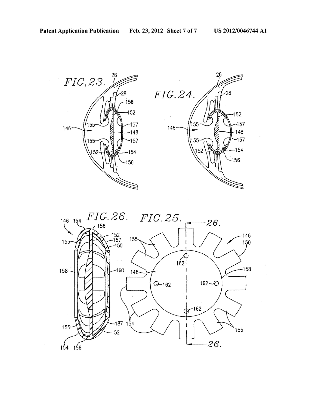 CAPSULAR INTRAOCULAR LENS IMPLANT HAVING A REFRACTIVE LIQUID THERE IN - diagram, schematic, and image 08