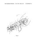 SYSTEMS AND METHODS FOR ZIPKNOT ACL FIXATION diagram and image