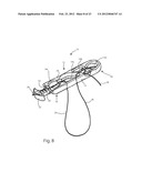 SYSTEMS AND METHODS FOR ZIPKNOT ACL FIXATION diagram and image