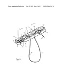 SYSTEMS AND METHODS FOR ZIPKNOT ACL FIXATION diagram and image