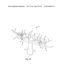 SYSTEMS AND METHODS FOR ZIPKNOT ACL FIXATION diagram and image