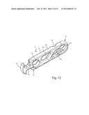 SYSTEMS AND METHODS FOR ZIPKNOT ACL FIXATION diagram and image