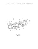 SYSTEMS AND METHODS FOR ZIPKNOT ACL FIXATION diagram and image