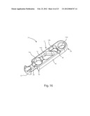 SYSTEMS AND METHODS FOR ZIPKNOT ACL FIXATION diagram and image