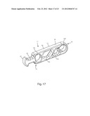 SYSTEMS AND METHODS FOR ZIPKNOT ACL FIXATION diagram and image