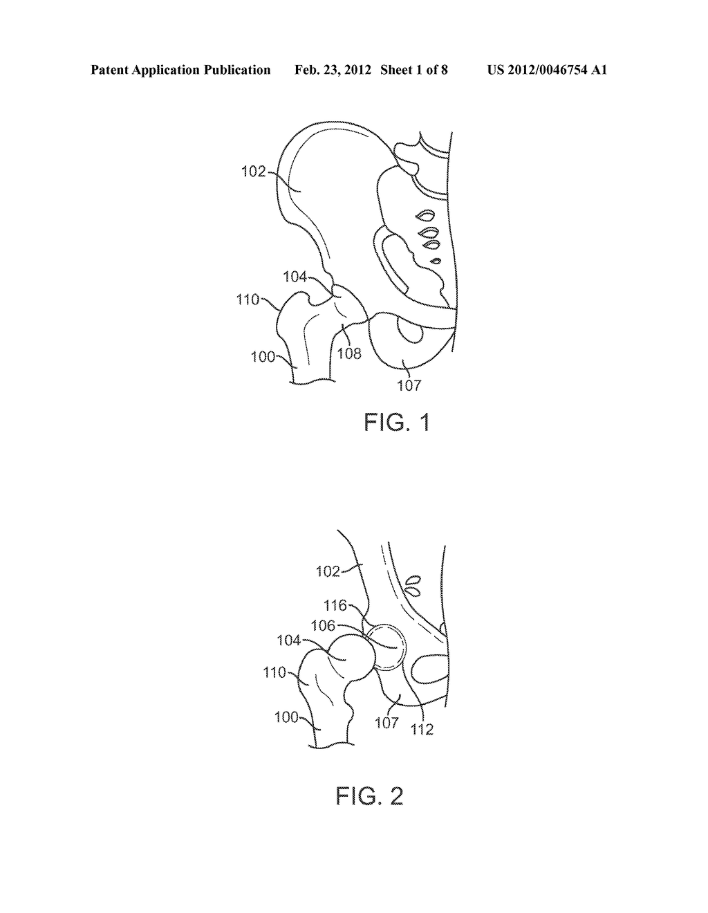 APPARATUS FOR CONTROLLING A LOAD ON A HIP JOINT - diagram, schematic, and image 02