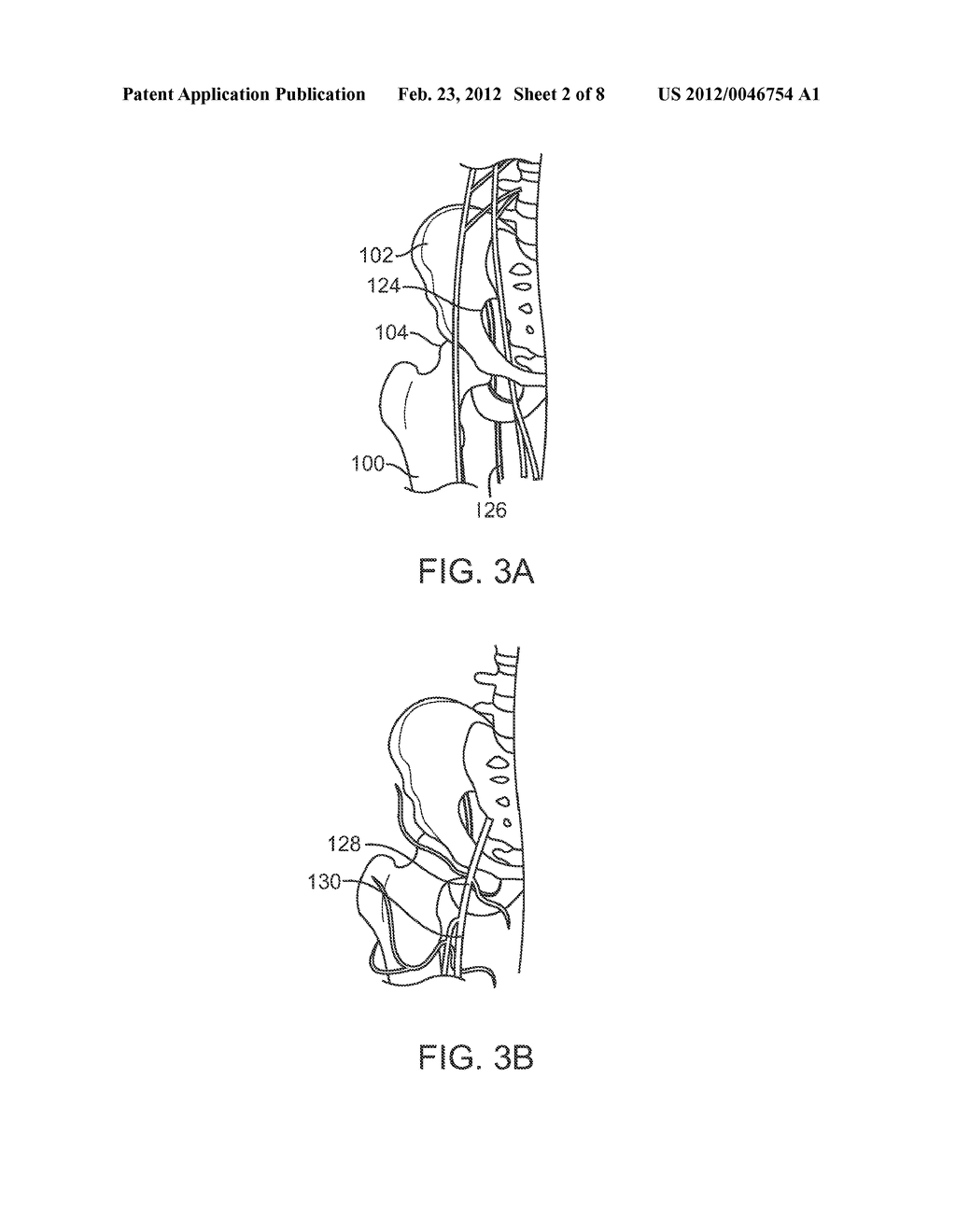 APPARATUS FOR CONTROLLING A LOAD ON A HIP JOINT - diagram, schematic, and image 03