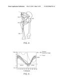 APPARATUS FOR CONTROLLING A LOAD ON A HIP JOINT diagram and image