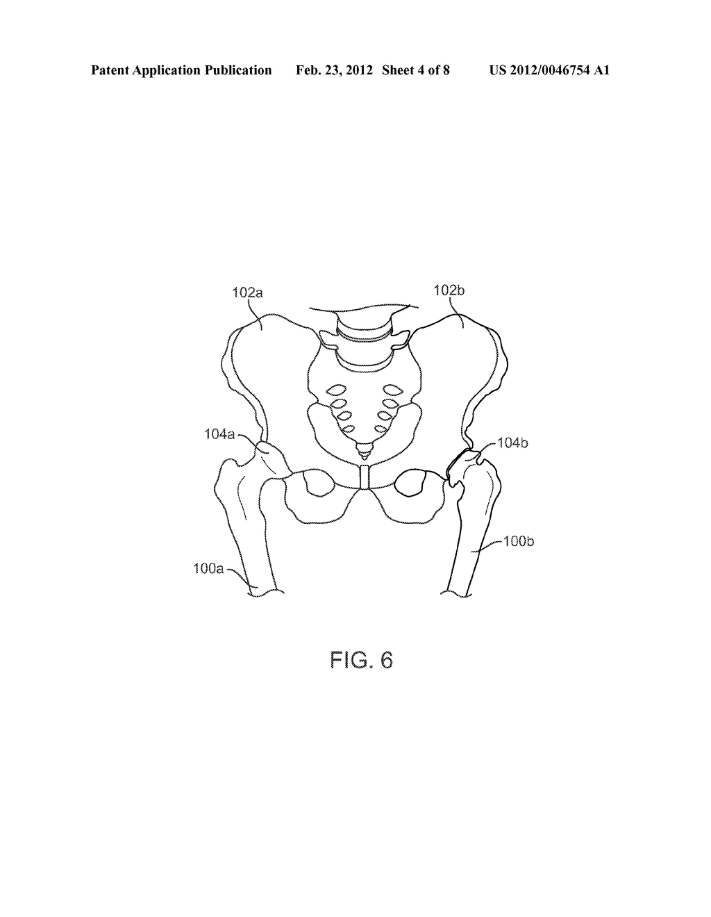 APPARATUS FOR CONTROLLING A LOAD ON A HIP JOINT - diagram, schematic, and image 05