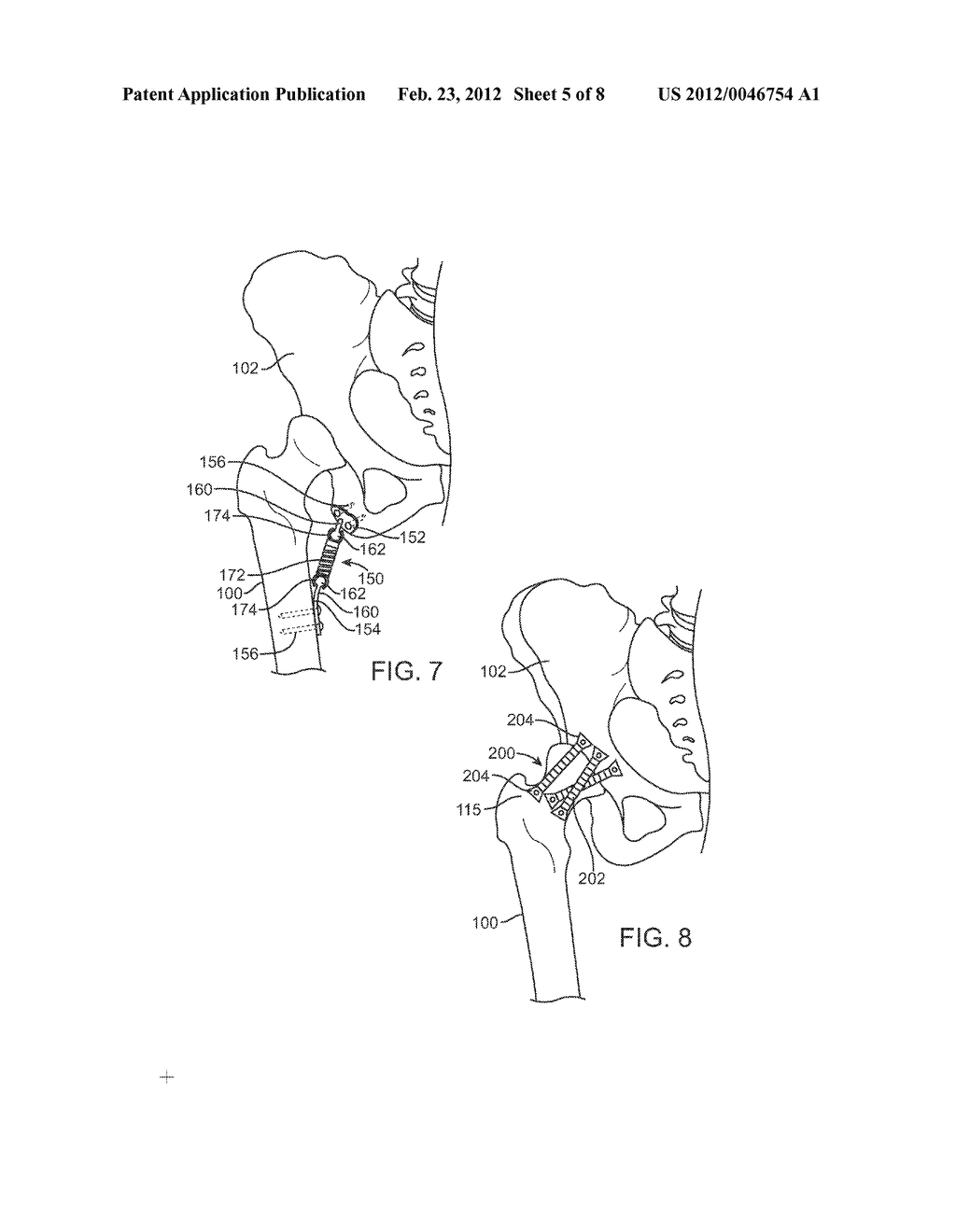 APPARATUS FOR CONTROLLING A LOAD ON A HIP JOINT - diagram, schematic, and image 06