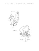 APPARATUS FOR CONTROLLING A LOAD ON A HIP JOINT diagram and image