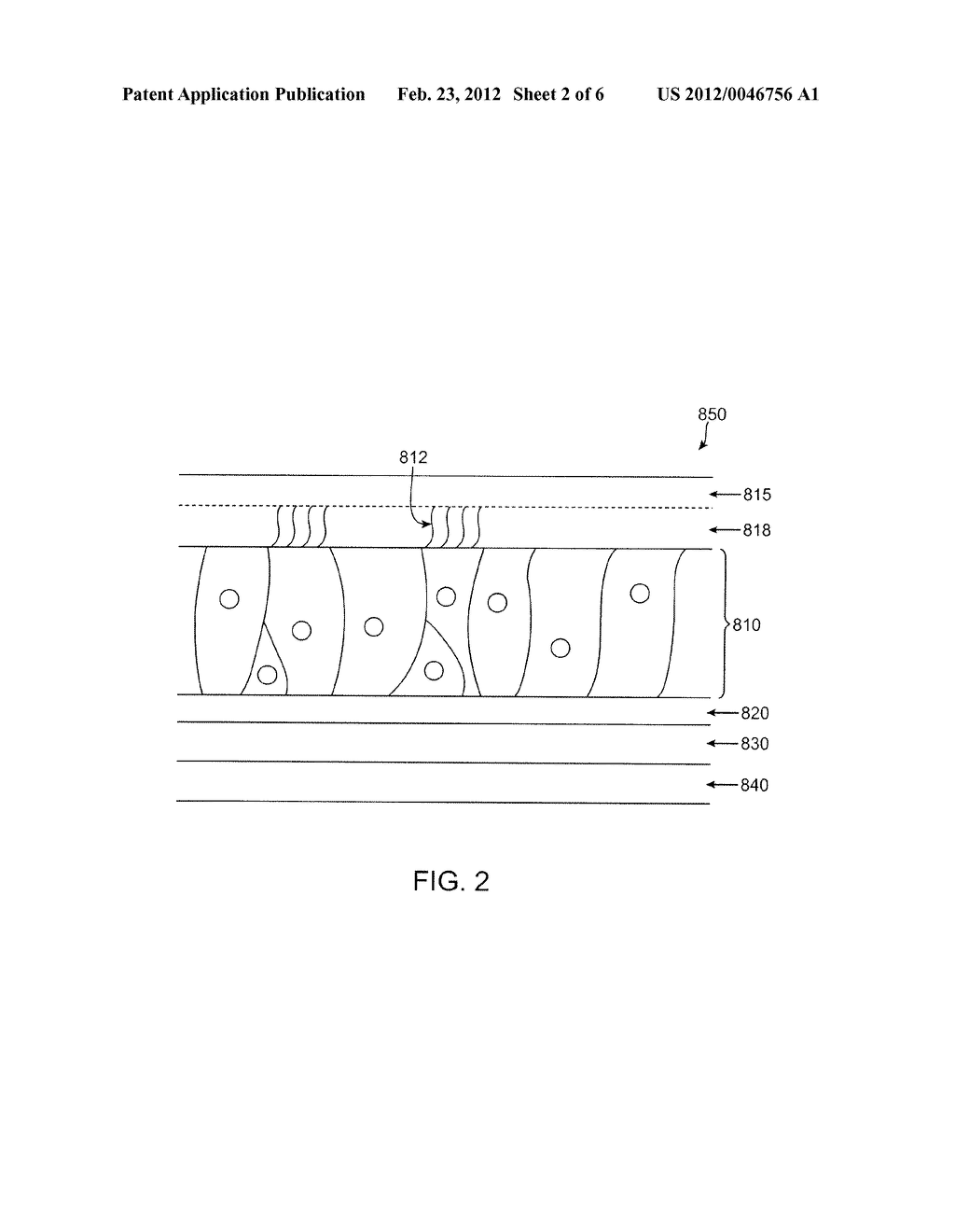 TREATMENT OF NASAL CAVITIES WITH STENT HAVING A SOFT OUTER LAYER - diagram, schematic, and image 03